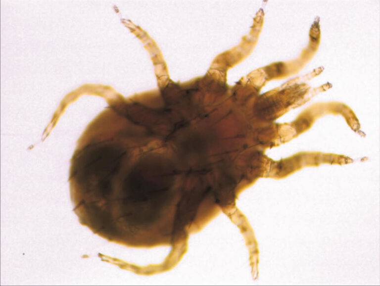 Varíola por riquétsia – causas, sintomas e tratamentos