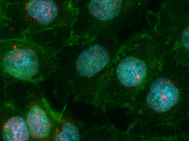 Maneiras de equilibrar hormônios para vencer doenças autoimunes