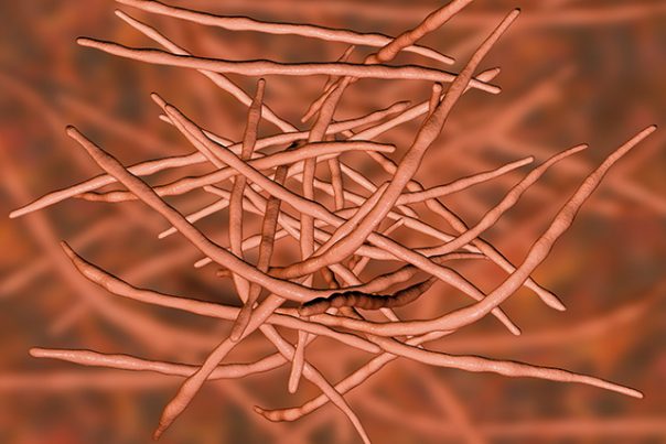 Actinomicose: causas, efeitos colaterais e tratamentos