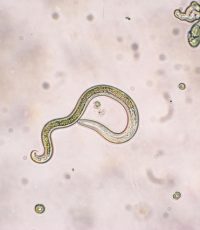 Larva migrans visceral – causas, sintomas e tratamentos