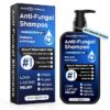 Shampoo Anticaspa Oely 10.1 Fl Oz - Alívio Rápido para Coceira e Vermelhidão no Couro Cabeludo