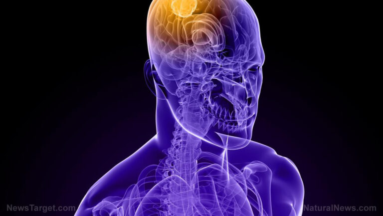 Descoberta revolucionária: Cientistas identificam origem do Alzheimer em células imunes inflamadas