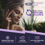 Clear Skin Peak Curative 30g - Tratamento Avançado para Acne e Rosácea - 3