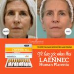 LAENNEC - Hidrolisado de Placenta Humana 2 ml por ampola - Pacote com 10 ampolas para Saúde e Beleza