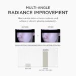 Ampola SKIN1004 Niacinamide 10% - Serum Facial com Ácido Tranexâmico e Centella da Madagascar para Peles Uniformes - 6